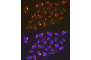 Immunofluorescence analysis of U-2 OS cells using TGN46/TGOLN2 Rabbit mAb (ABIN7270875) at dilution of 1:100 (40x lens). (TGOLN2 antibody)
