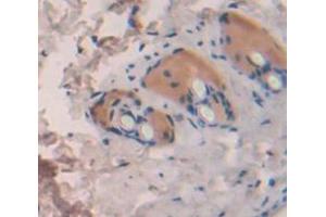 Used in DAB staining on fromalin fixed paraffin- embedded Kidney tissue (IL1F10 antibody  (AA 15-152))