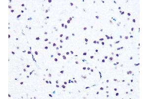Immunohistochemistry of paraffin-embedded rat brain using NUM Rabbit mAb (ABIN7269002) at dilution of 1:100 (40x lens). (NUMA1 antibody)