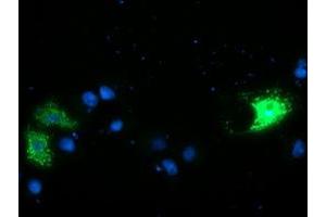 Anti-CAMLG mouse monoclonal antibody (ABIN2455605) immunofluorescent staining of COS7 cells transiently transfected by pCMV6-ENTRY CAMLG (RC218292). (CAMLG antibody)