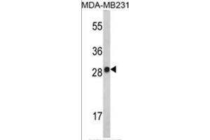 Western blot analysis of AP17501PU-N IL2 Antibody (Center) in MDA-MB231 cell line lysates (35 µg/lane). (IL-2 antibody  (AA 57-86))
