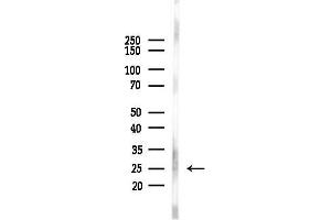 Western blot analysis of lysates from Mouse brain, using R Antibody at 1/1000 dilution.