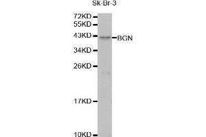 Western Blotting (WB) image for anti-Biglycan (BGN) (AA 20-230) antibody (ABIN1678858) (Biglycan antibody  (AA 20-230))