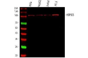 Western blot analysis of Hsp105 using anti-Hsp105 antibody (ABIN5693036).