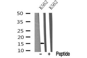 Western blot analysis of VAMP4 in lysates of K562? (VAMP4 antibody  (N-Term))