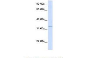 Image no. 1 for anti-Geranylgeranyl Diphosphate Synthase 1 (GGPS1) (AA 180-229) antibody (ABIN6738471) (GGPS1 antibody  (AA 180-229))