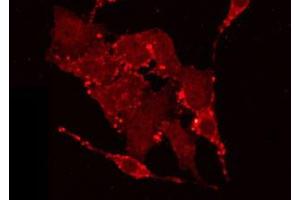 ABIN6266930 staining LOVO by IF/ICC. (AKAP2 antibody  (N-Term))