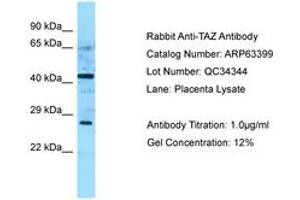 Image no. 1 for anti-Tafazzin (TAZ) (AA 192-241) antibody (ABIN6749979) (TAZ antibody  (AA 192-241))