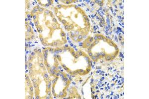 Immunohistochemistry of paraffin-embedded human kidney using DPYD antibody at dilution of 1:100 (x400 lens).
