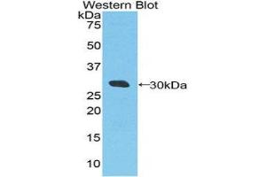 Western Blotting (WB) image for anti-DEAD (Asp-Glu-Ala-Asp) Box Polypeptide 58 (DDX58) (AA 550-776) antibody (ABIN1860445) (DDX58 antibody  (AA 550-776))