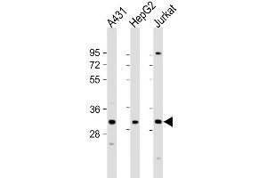 Western Blot at 1:1000 dilution Lane 1: A431 whole cell lysate Lane 2: HepG2 whole cell lysate Lane 3: Jurkat whole cell lysate Lysates/proteins at 20 ug per lane.