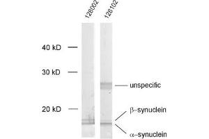 dilution: 1 : 1000, sample: crude synaptosomal fraction of rat brain (P2) (Alpha, beta Synuclein (AA 2-25), (N-Term) antibody)