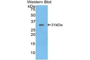 Western Blotting (WB) image for anti-LIM and Senescent Cell Antigen-Like Domains 1 (LIMS1) (AA 68-303) antibody (ABIN1859667) (LIMS1 antibody  (AA 68-303))