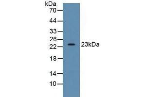Detection of SDF2 in Human HepG2 Cells using Polyclonal Antibody to Stromal Cell Derived Factor 2 (SDF2) (SDF2 antibody  (AA 19-211))