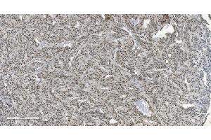 IHC analysis of HP1 alpha/CBX5 using anti-HP1 alpha/CBX5 antibody (ABIN7599057). (CBX5 antibody  (AA 1-191))