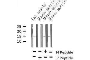 Western blot analysis of Phospho-Histone H2A (Thr121) expression in various lysates (Histone H2A antibody  (pThr121))