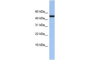 Human Placenta; WB Suggested Anti-ABAT Antibody Titration: 0. (ABAT antibody  (Middle Region))