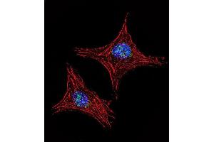 Confocal immunofluorescent analysis of UTY Antibody (C-term) (ABIN653016 and ABIN2842639) with MDA-M cell followed by Alexa Fluor 488-conjugated goat anti-rabbit lgG (green). (UTY antibody  (C-Term))