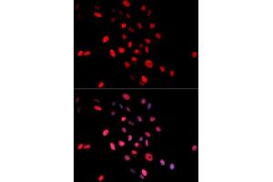 Immunofluorescence analysis of MCF7 cell using Phospho-c-Jun-S63 antibody. (C-JUN antibody  (pSer63))