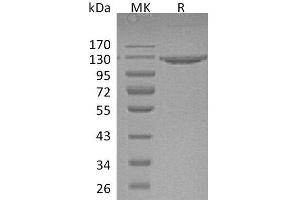 Western Blotting (WB) image for Vascular Cell Adhesion Molecule 1 (VCAM1) protein (Fc Tag) (ABIN7320757) (VCAM1 Protein (Fc Tag))