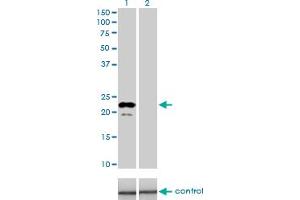 Western blot analysis of APOM over-expressed 293 cell line, cotransfected with APOM Validated Chimera RNAi (Lane 2) or non-transfected control (Lane 1).