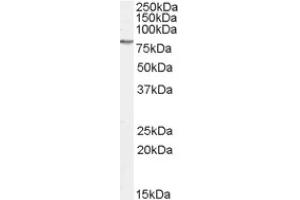 Image no. 1 for anti-GRB2-Associated Binding Protein 2 (GAB2) (C-Term), (Internal Region) antibody (ABIN374757) (GAB2 antibody  (C-Term, Internal Region))