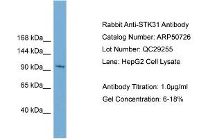 WB Suggested Anti-STK31  Antibody Titration: 0. (STK31 antibody  (N-Term))