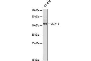 Western blot analysis of extracts of BT-474 cells, using LMX1B antibody  at 1:1000 dilution. (LMX1B antibody  (AA 136-395))