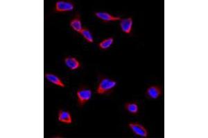 Immunofluorescence analysis of SOX9 polyclonal antibody  in HeLa cells. (SOX9 antibody  (N-Term))