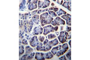 PC Antibody (N-term) (ABIN656425 and ABIN2845717) immunohistochemistry analysis in formalin fixed and paraffin embedded human pancreas tissue followed by peroxidase conjugation of the secondary antibody and DAB staining. (PC (AA 53-82), (N-Term) antibody)