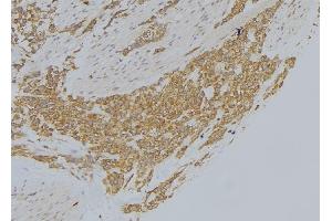 ABIN6273008 at 1/100 staining Human lung tissue by IHC-P. (MICAL1 antibody  (Internal Region))