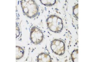 Immunohistochemistry of paraffin-embedded human colon using ACCS antibody at dilution of 1:200 (40x lens). (PHACS antibody)