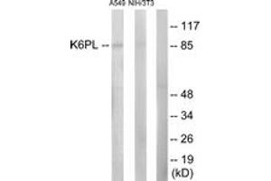 Western Blotting (WB) image for anti-Phosphofructokinase, Liver (PFKL) (AA 691-740) antibody (ABIN2889409) (PFKL antibody  (AA 691-740))