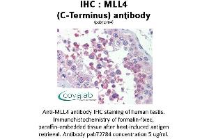 Image no. 2 for anti-Histone-Lysine N-Methyltransferase MLL4 (MLL4) (C-Term) antibody (ABIN1736980)