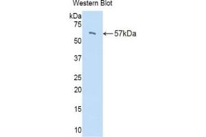 Detection of Recombinant PI16, Mouse using Polyclonal Antibody to Peptidase Inhibitor 16 (PI16) (PI16 antibody  (AA 21-468))