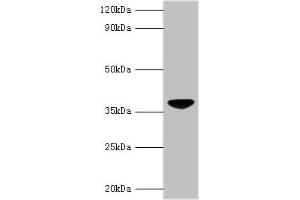 anti-Chicken Anemia Virus VP3 (CAV VP3) (AA 1-121) antibody