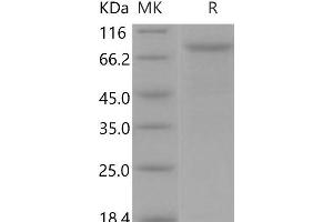 Western Blotting (WB) image for Cadherin 5 (CDH5) protein (His tag) (ABIN7320374) (Cadherin 5 Protein (CDH5) (His tag))