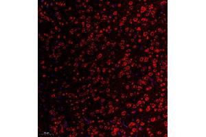 Immunofluorescent analysis of paraffin embedded mouse substantia nigra using RPL10L (ABIN7075429) at dilution of 1: 650 (RPL10L antibody)