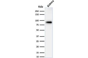 ABIN6383807 to Calnexin was successfully used to stain an approx. (Calnexin antibody  (Lumenal Region))