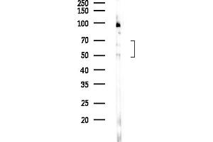anti-Hexosaminidase B (Beta Polypeptide) (HEXB) (C-Term) antibody