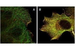 Immunofluorescence (IF) image for anti-V-Akt Murine Thymoma Viral Oncogene Homolog 1 (AKT1) (Ser473) antibody (ABIN400784) (AKT1 antibody  (Ser473))