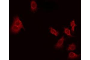ABIN6275628 staining Hela by IF/ICC. (THAP4 antibody  (Internal Region))