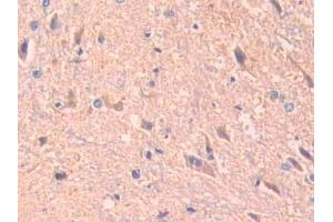 DAB staining on IHC-P; Samples: Rat Spinal cord Tissue (ADAM10 antibody  (AA 218-445))