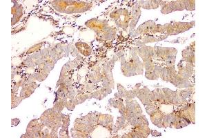 IHC analysis of ARA9/AIP using anti-ARA9/AIP antibody (ABIN6719423). (AIP antibody  (AA 91-330))