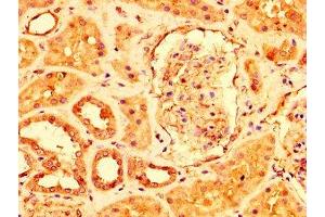 IHC image of ABIN7174328 diluted at 1:500 and staining in paraffin-embedded human kidney tissue performed on a Leica BondTM system. (USP4 antibody  (AA 632-810))