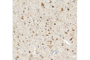 IHC analysis of NeuN/RBFOX3 using anti-NeuN/RBFOX3 antibody (ABIN7601068).