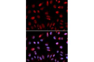 Immunofluorescence analysis of U2OS cells using HUS1 antibody (ABIN6131777, ABIN6142085, ABIN6142087 and ABIN6221056). (HUS1 antibody  (AA 1-280))