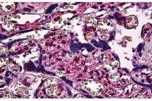 Human Placenta: Formalin-Fixed, Paraffin-Embedded (FFPE) (SMAD3 antibody  (AA 120-222))