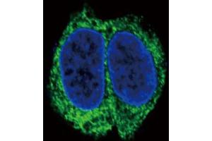 Immunofluorescence (IF) image for anti-Transforming Growth Factor, beta Receptor II (70/80kDa) (TGFBR2) antibody (ABIN2996408)