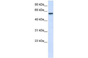 WB Suggested Anti-TRIM41 Antibody Titration:  0. (TRIM41 antibody  (Middle Region))